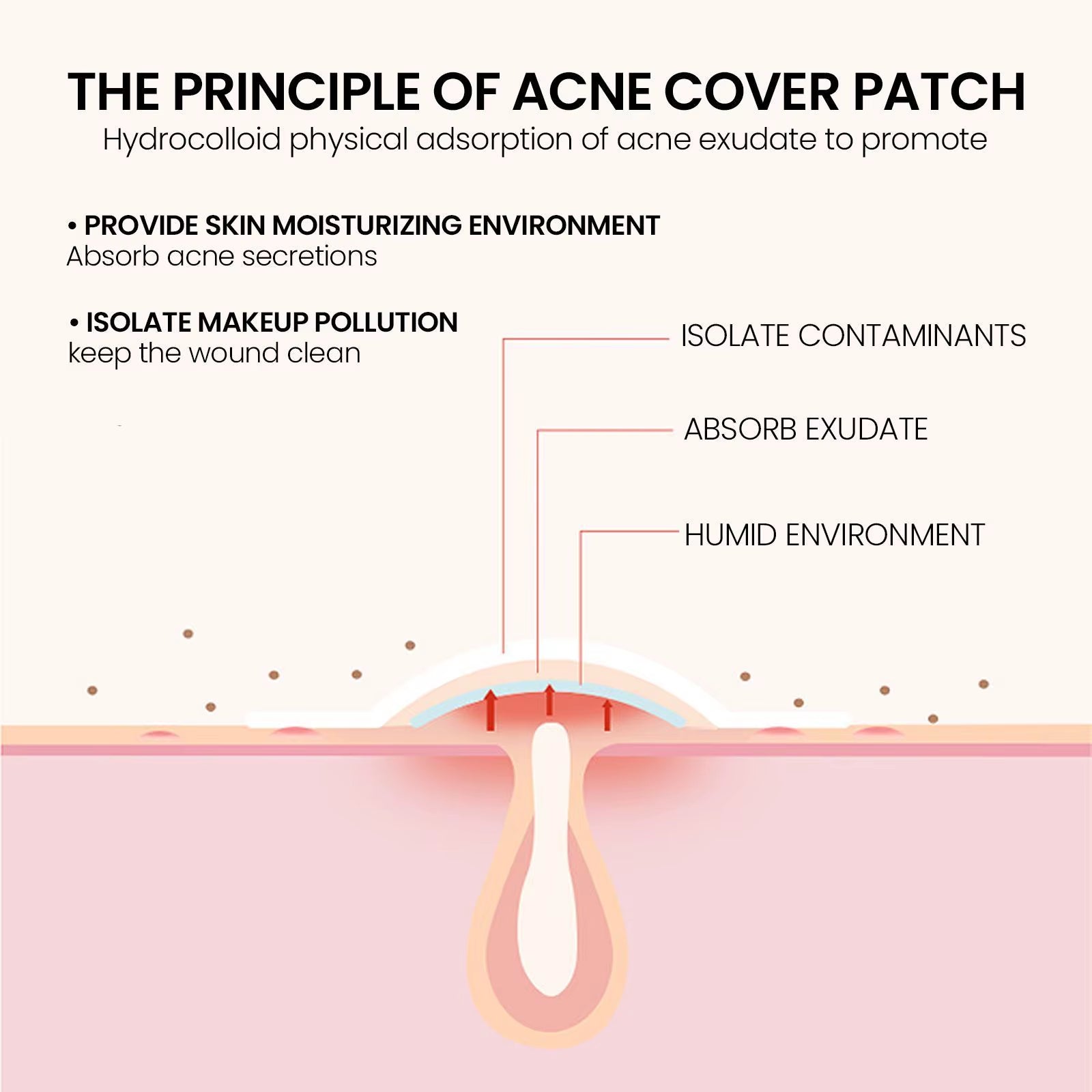 240 Pieces of Multi-Color Star Acne Patches, Facial Acne Patches, Concealer Acne Patches, and Pimples Patches, Ultra-Thin